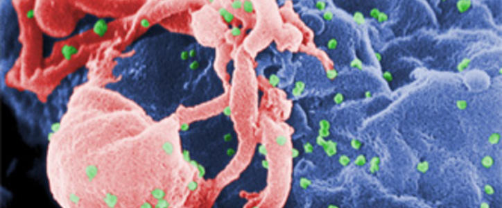 Учёные назвали время и место первого ВИЧ-заражения